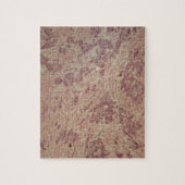 Puzzle Cancer du sein sous le microscope (Vertical)