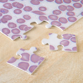 Puzzle Cellules sanguines du paludisme (Côté)