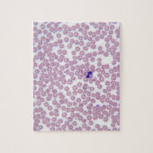 Puzzle Cellules sanguines du paludisme (Vertical)