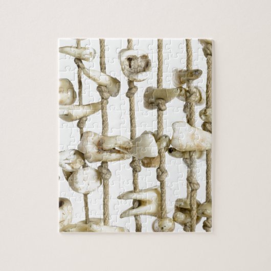 Puzzle Dentiste de dents extrait par photographie (Vertical)
