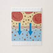 Puzzle Dialyse rénale (Vertical)