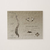 Puzzle Épine (Horizontal)