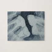 Puzzle Gros plan d'une radiographie dentaire (Horizontal)