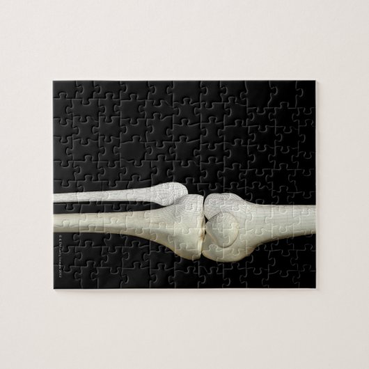 Puzzle Os du genou 4 (Horizontal)