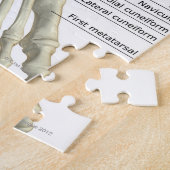 Puzzle Os du pied 6 (Côté)