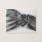 Puzzle Poignets normaux, rayons X (Horizontal)