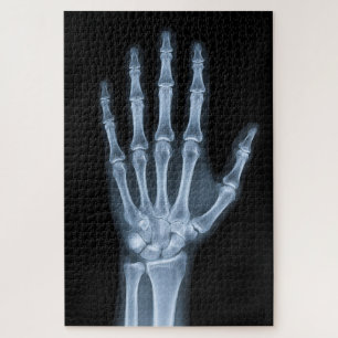 Puzzle Radiographie clinique de la main