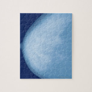 Puzzle Rayon X de sein femelle, vue de côté