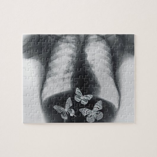 Puzzle Rayon X des papillons dans l'estomac (Horizontal)