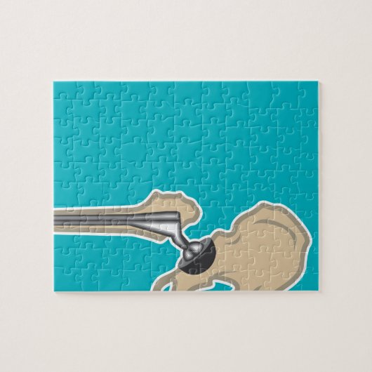 Puzzle Remplacement d'articulation de la hanche (Horizontal)