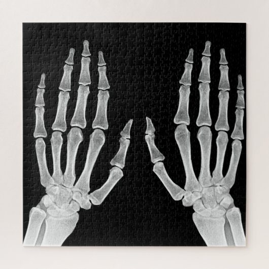Puzzle Skeleton Hands Xray Photo Anatomie humaine photo (Vertical)