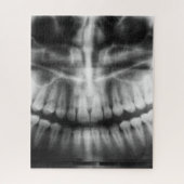 Puzzle X-Ray Teeth Bouche sourire noir et blanc (Vertical)