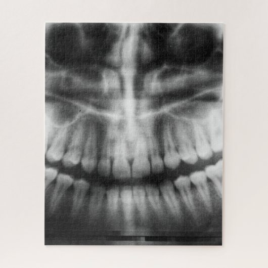 Puzzle X-Ray Teeth Bouche sourire noir et blanc (Vertical)