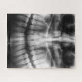 Puzzle X-Ray Teeth Bouche sourire noir et blanc (Horizontal)