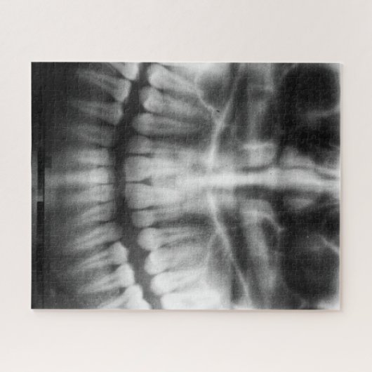 Puzzle X-Ray Teeth Bouche sourire noir et blanc (Horizontal)