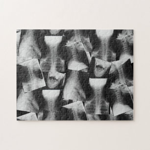 Puzzle X-Rayed (original)