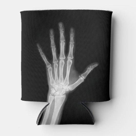 Rafraîchisseur Pour Canette B&W X-Ray Arm Skeleton Bones (Devant)