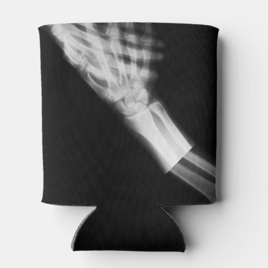 Rafraîchisseur Pour Canette B&W X-Ray Skeleton Shake main (Dos)