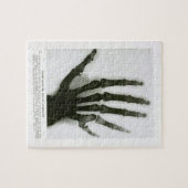 Rayon X de six puzzles digités de main (Horizontal)