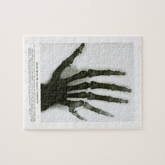 Rayon X de six puzzles digités de main (Horizontal)