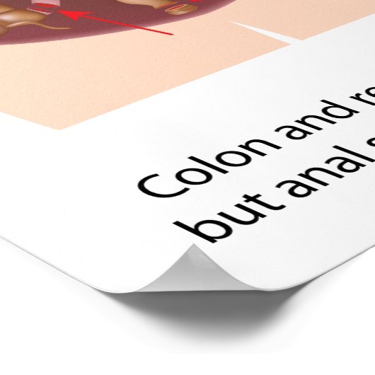 Restoratieve proctocolectomie chirurgie met j-pouc poster (Hoek)