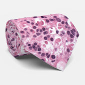 Retinocytoma: Fleuretten Stropdas (Opgerold)