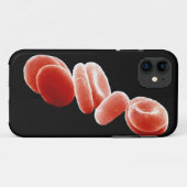 Rode bloedcellen Case-Mate iPhone case (Achterkant (horizontaal))