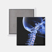 Röntgenafbeelding van de botten van de nek magneet (Voorkant / Achterkant)