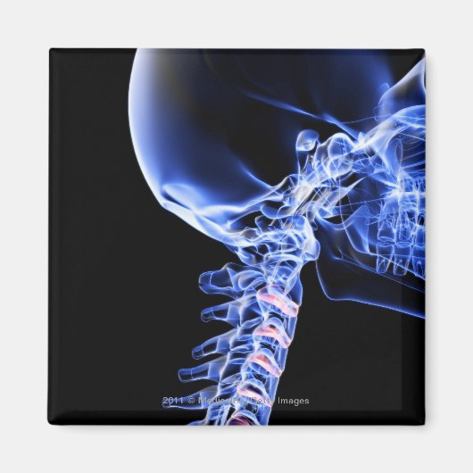 Röntgenafbeelding van de botten van de nek magneet (Voorkant)