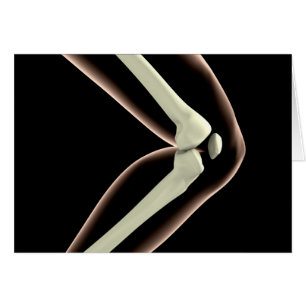 RöntgenAfbeelding van knie 1