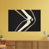 RöntgenAfbeelding van knie 1 Canvas Afdruk (Insitu (Woonkamer))