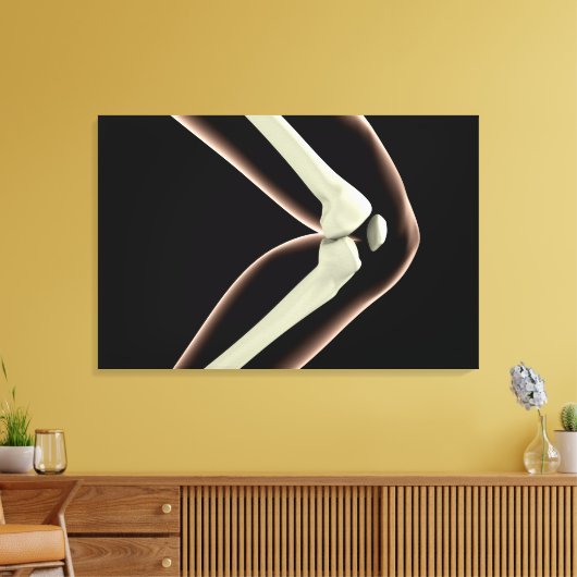 RöntgenAfbeelding van knie 1 Canvas Afdruk (Insitu (Woonkamer))