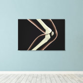 RöntgenAfbeelding van knie 1 Canvas Afdruk (Insitu (Houten vloer))