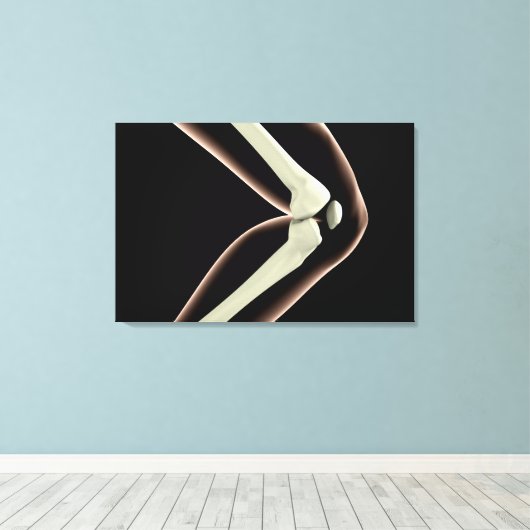 RöntgenAfbeelding van knie 1 Canvas Afdruk (Insitu (Houten vloer))