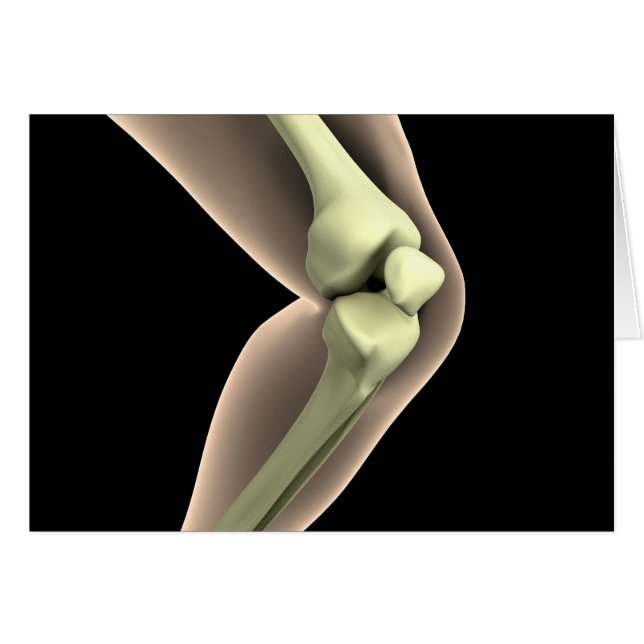 RöntgenAfbeelding van knie 2 (Voorkant Horizontaal)