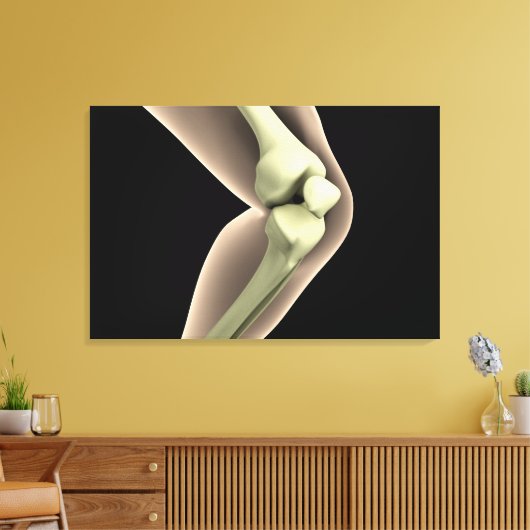 RöntgenAfbeelding van knie 2 Canvas Afdruk (Insitu (Woonkamer))