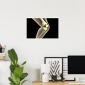 RöntgenAfbeelding van knie 2 Poster (Thuiskantoor)