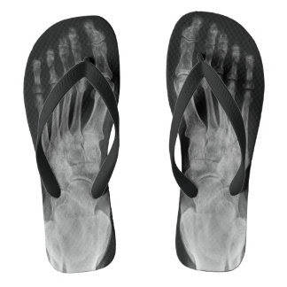 Röntgenanatomie skelet poten koele flip-pons teenslippers