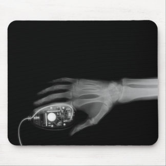 Röntgenfoto hand- en computermuis muismat