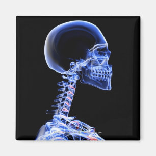 röntgenfoto van de botten in de nek magneet