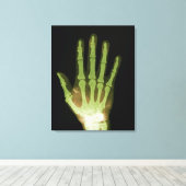 Röntgenfoto van hand van mens canvas afdruk (Insitu (Houten vloer))