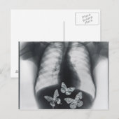 Röntgenfoto van vlinders in de maag briefkaart (Voorkant / Achterkant)