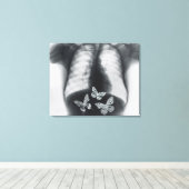 Röntgenfoto van vlinders in de maag canvas afdruk (Insitu (Houten vloer))