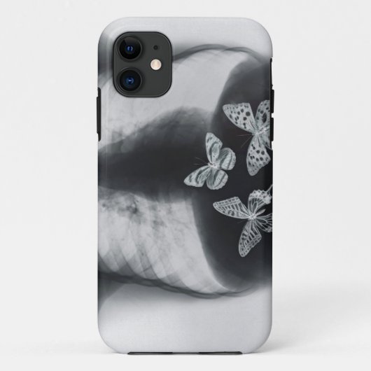 Röntgenfoto van vlinders in de maag Case-Mate iPhone case (Achterkant)