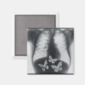 Röntgenfoto van vlinders in de maag magneet (Voorkant / Achterkant)