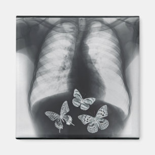 Röntgenfoto van vlinders in de maag magneet