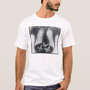 Röntgenfoto van vlinders in de maag t-shirt