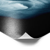 röntgenfoto's foto afdruk (Hoek)