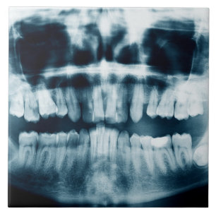 röntgenfoto's tegeltje
