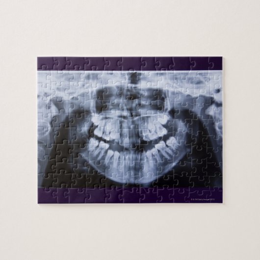 Röntgenfoto's van een meiden met een panoramisch k legpuzzel (Horizontaal)